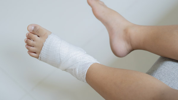 Casting-and-Splinting Dry Needling