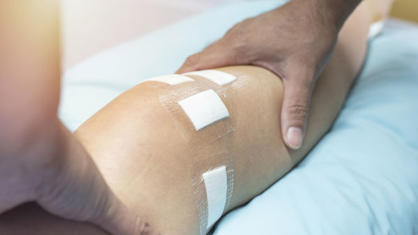 Post-Operative Rehabilitation